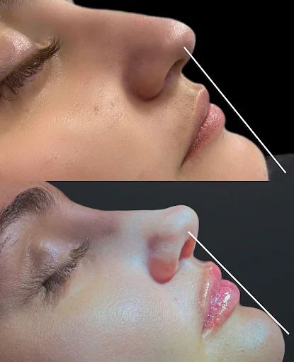 Comparativo visual de procedimento labial publicado pela clínica