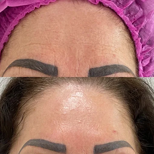 Comparativo visual de procedimento facial publicado pela clínica